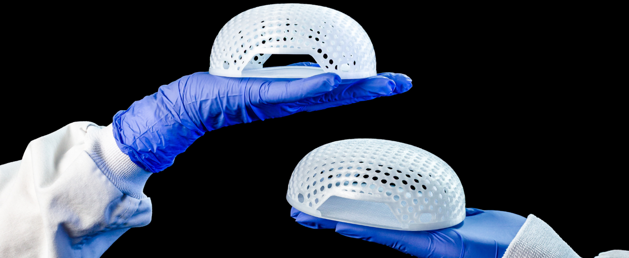 Implant MATTISSE
