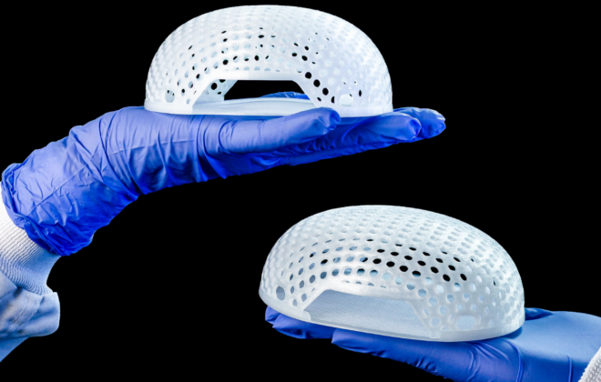 Implant MATTISSE